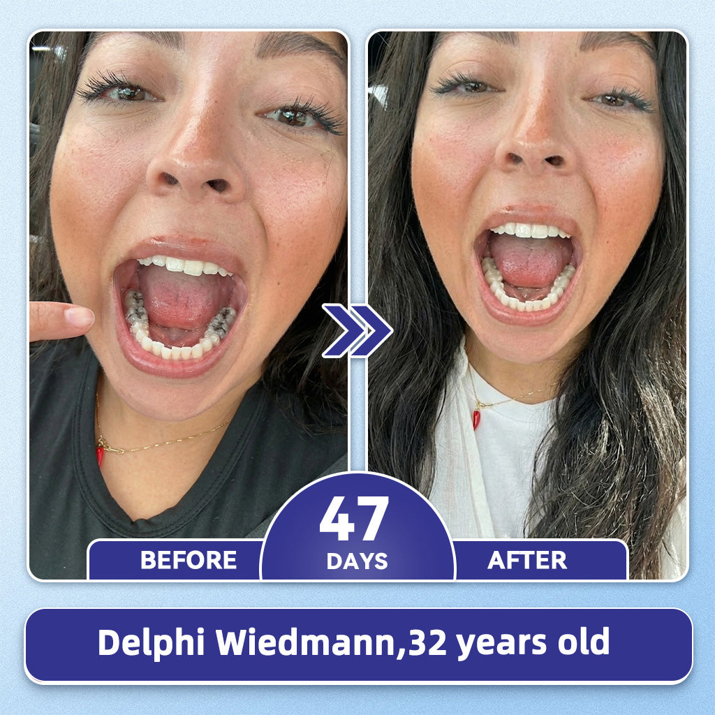 GаrаgеLіnе® 🦷 Tideglusib Fast‑Dissolving Tooth & Gum Repair Oral Strips 😁 (Supports tooth repair and helps relieve gum discomfort and other common oral concerns)