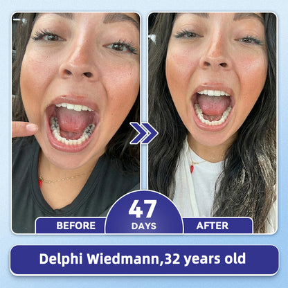 GаrаgеLіnе® 🦷 Tideglusib Fast‑Dissolving Tooth & Gum Repair Oral Strips 😁 (Supports tooth repair and helps relieve gum discomfort and other common oral concerns)