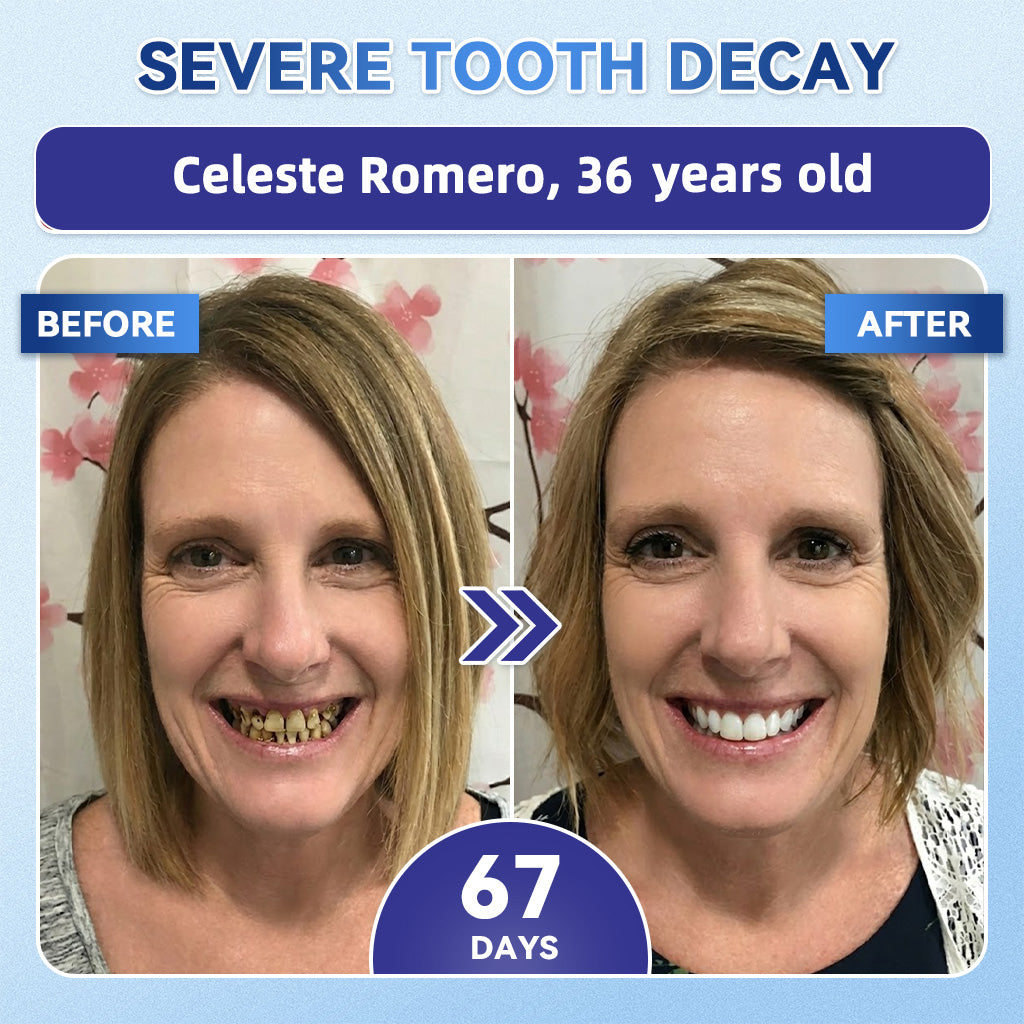 GаrаgеLіnе® 🦷 Tideglusib Fast‑Dissolving Tooth & Gum Repair Oral Strips 😁 (Supports tooth repair and helps relieve gum discomfort and other common oral concerns)