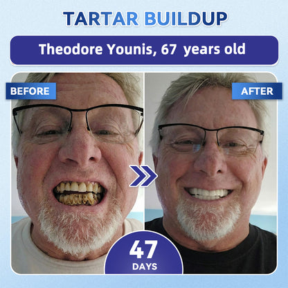 GаrаgеLіnе® 🦷 Tideglusib Fast‑Dissolving Tooth & Gum Repair Oral Strips 😁 (Supports tooth repair and helps relieve gum discomfort and other common oral concerns)
