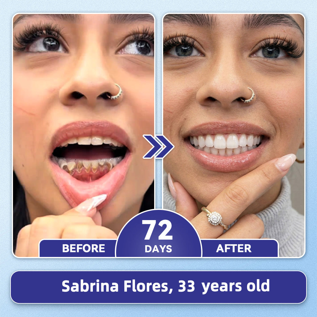 GаrаgеLіnе® 🦷 Tideglusib Fast‑Dissolving Tooth & Gum Repair Oral Strips 😁 (Supports tooth repair and helps relieve gum discomfort and other common oral concerns)