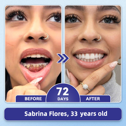 GаrаgеLіnе® 🦷 Tideglusib Fast‑Dissolving Tooth & Gum Repair Oral Strips 😁 (Supports tooth repair and helps relieve gum discomfort and other common oral concerns)