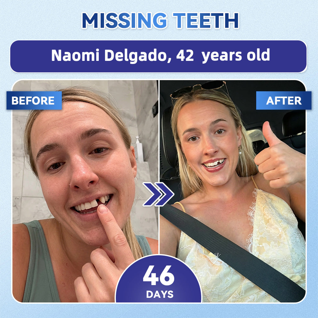 GаrаgеLіnе® 🦷 Tideglusib Fast‑Dissolving Tooth & Gum Repair Oral Strips 😁 (Supports tooth repair and helps relieve gum discomfort and other common oral concerns)