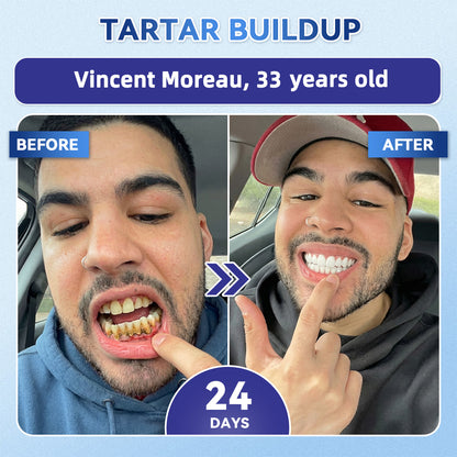 GаrаgеLіnе® 🦷 Tideglusib Fast‑Dissolving Tooth & Gum Repair Oral Strips 😁 (Supports tooth repair and helps relieve gum discomfort and other common oral concerns)