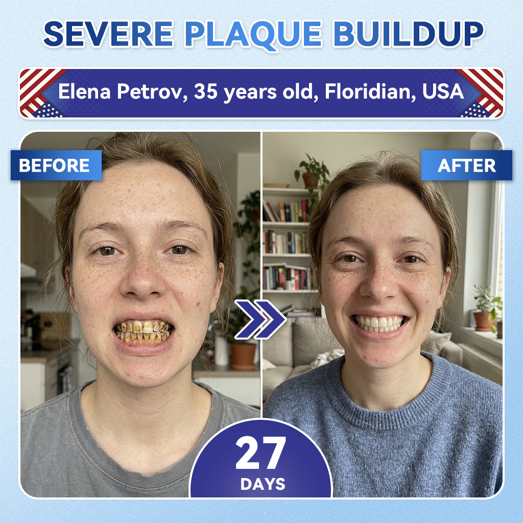 GаrаgеLіnе® 🦷 Tideglusib Fast‑Dissolving Tooth & Gum Repair Oral Strips 🔥 (Supports tooth repair and helps relieve gum discomfort and other common oral concerns) (Copy)