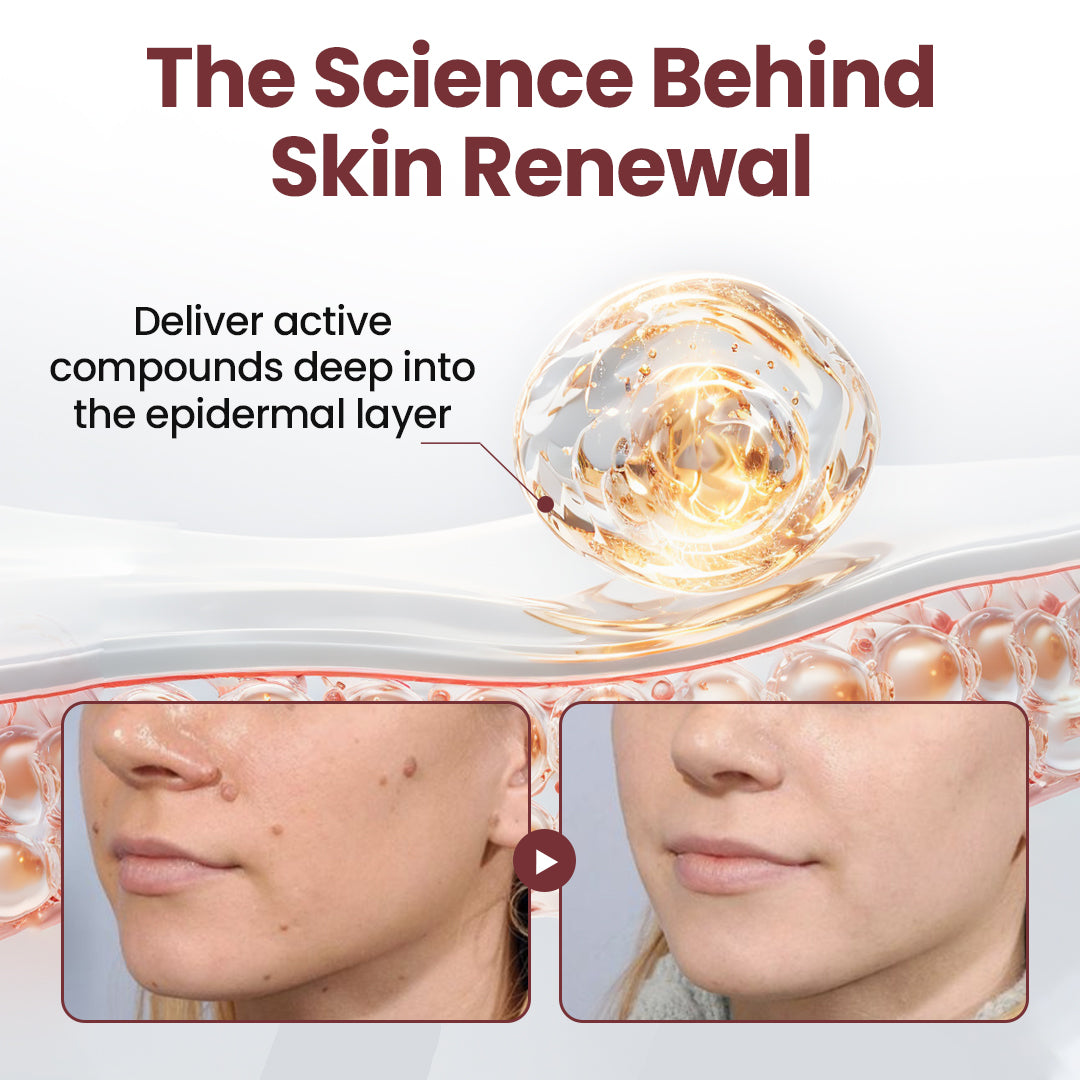 𝑶𝒇𝒇𝒊𝒄𝒊𝒂𝒍 𝒔𝒕𝒐𝒓𝒆丨🩺 𝑪𝒖𝒓𝒆𝑽𝒊𝒗𝒐®  Dual-Action Renewal Cream KeraErase.