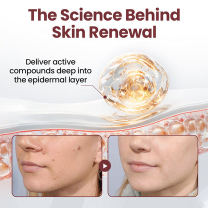 𝑶𝒇𝒇𝒊𝒄𝒊𝒂𝒍 𝒔𝒕𝒐𝒓𝒆丨🩺 𝑪𝒖𝒓𝒆𝑽𝒊𝒗𝒐®  Dual-Action Renewal Cream KeraErase.