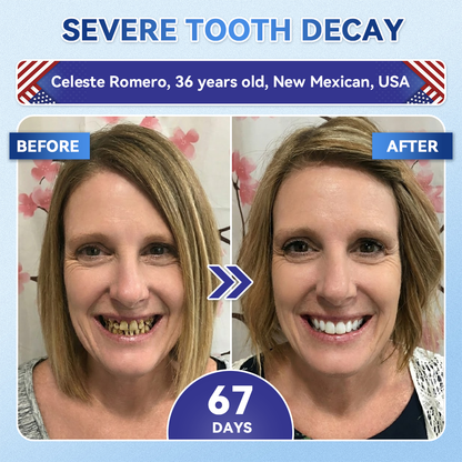 GаrаgеLіnе® 🦷 Tideglusib Fast‑Dissolving Tooth & Gum Repair Oral Strips 🔥 (Supports tooth repair and helps relieve gum discomfort and other common oral concerns) (Copy)