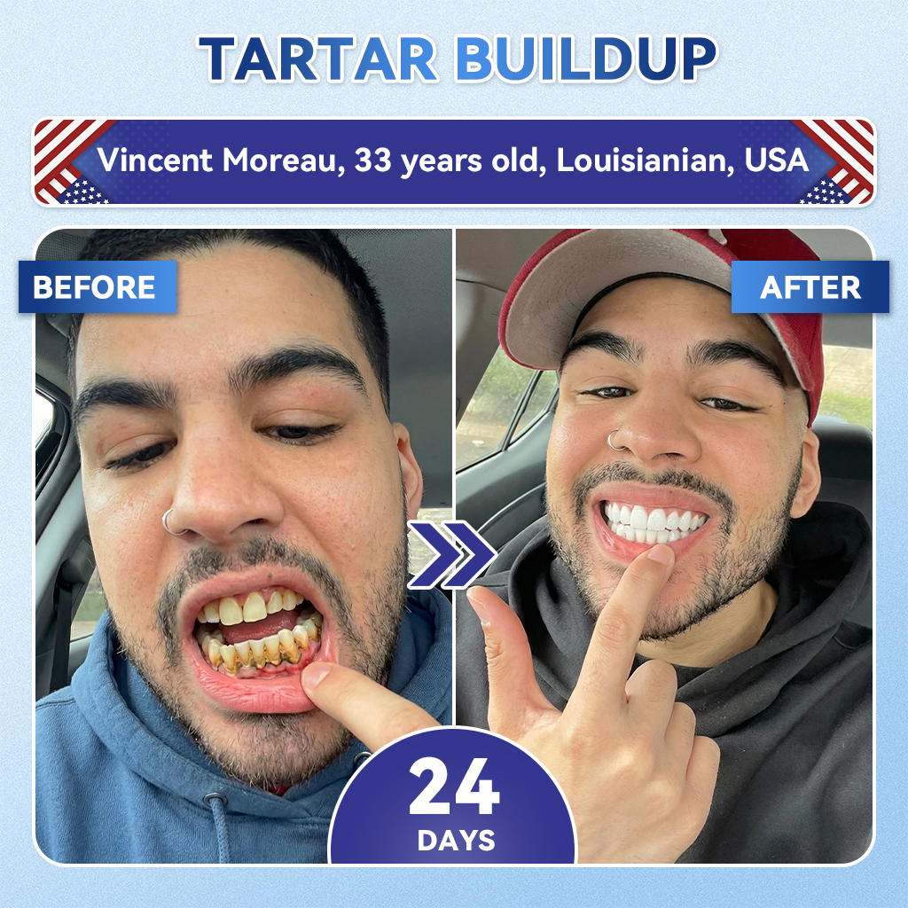GаrаgеLіnе® 🦷 Tideglusib Fast‑Dissolving Tooth & Gum Repair Oral Strips 🔥 (Supports tooth repair and helps relieve gum discomfort and other common oral concerns) (Copy)