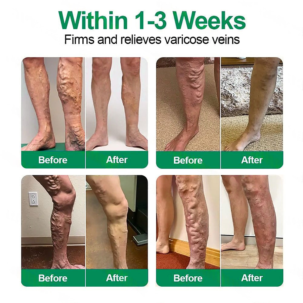 🇦🇺🥇✅ 𝐇𝐞𝐚𝐥𝐫𝐢𝐳𝐞® VеіnТаrgеt Місrоnееdlе Раtсh⚡Instant Relief, Long-Term Results