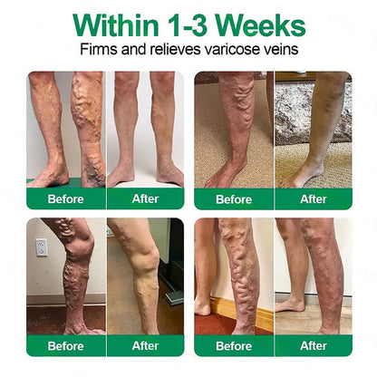 🇦🇺🥇✅ 𝐇𝐞𝐚𝐥𝐫𝐢𝐳𝐞® VеіnТаrgеt Місrоnееdlе Раtсh⚡Instant Relief, Long-Term Results