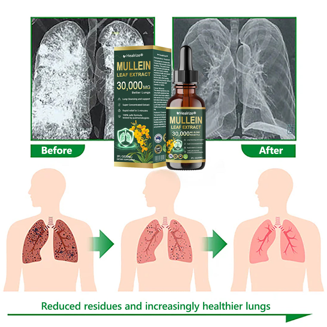 𝗢𝗳𝗳𝗶𝗰𝗶𝗮𝗹 | Healrize® 𝗢𝗿𝗴𝗮𝗻𝗶𝗰 𝗟𝘂𝗻𝗴 𝗖𝗹𝗲𝗮𝗻𝘀𝗶𝗻𝗴 𝗠𝘂𝗹𝗹𝗲𝗶𝗻 𝗟𝗲𝗮𝗳 𝗘𝘅𝘁𝗿𝗮𝗰𝘁 𝗗𝗿𝗼𝗽𝘀 🫁 𝐂𝐥𝐢𝐧𝐢𝐜𝐚𝐥𝐥𝐲 𝐩𝐫𝐨𝐯𝐞𝐧, 𝐡𝐢𝐠𝐡𝐥𝐲 𝐜𝐨𝐧𝐜𝐞𝐧𝐭𝐫𝐚𝐭𝐞𝐝 𝐟𝐨𝐫𝐦𝐮𝐥𝐚 𝐭𝐡𝐚𝐭 𝐫𝐞𝐥𝐢𝐞𝐯𝐞𝐬 𝐜𝐨𝐮𝐠𝐡, 𝐩𝐡𝐥𝐞𝐠𝐦, 𝐚𝐬𝐭𝐡𝐦𝐚 & 𝐂𝐎𝐏𝐃 — 𝐛𝐫𝐞𝐚𝐭𝐡𝐞 𝐞𝐚𝐬𝐢𝐞𝐫, 𝐟𝐚𝐬𝐭𝐞𝐫