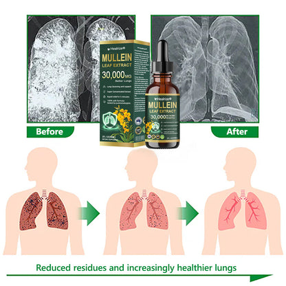 𝗢𝗳𝗳𝗶𝗰𝗶𝗮𝗹 | Healrize® 𝗢𝗿𝗴𝗮𝗻𝗶𝗰 𝗟𝘂𝗻𝗴 𝗖𝗹𝗲𝗮𝗻𝘀𝗶𝗻𝗴 𝗠𝘂𝗹𝗹𝗲𝗶𝗻 𝗟𝗲𝗮𝗳 𝗘𝘅𝘁𝗿𝗮𝗰𝘁 𝗗𝗿𝗼𝗽𝘀 🫁 𝐂𝐥𝐢𝐧𝐢𝐜𝐚𝐥𝐥𝐲 𝐩𝐫𝐨𝐯𝐞𝐧, 𝐡𝐢𝐠𝐡𝐥𝐲 𝐜𝐨𝐧𝐜𝐞𝐧𝐭𝐫𝐚𝐭𝐞𝐝 𝐟𝐨𝐫𝐦𝐮𝐥𝐚 𝐭𝐡𝐚𝐭 𝐫𝐞𝐥𝐢𝐞𝐯𝐞𝐬 𝐜𝐨𝐮𝐠𝐡, 𝐩𝐡𝐥𝐞𝐠𝐦, 𝐚𝐬𝐭𝐡𝐦𝐚 & 𝐂𝐎𝐏𝐃 — 𝐛𝐫𝐞𝐚𝐭𝐡𝐞 𝐞𝐚𝐬𝐢𝐞𝐫, 𝐟𝐚𝐬𝐭𝐞𝐫