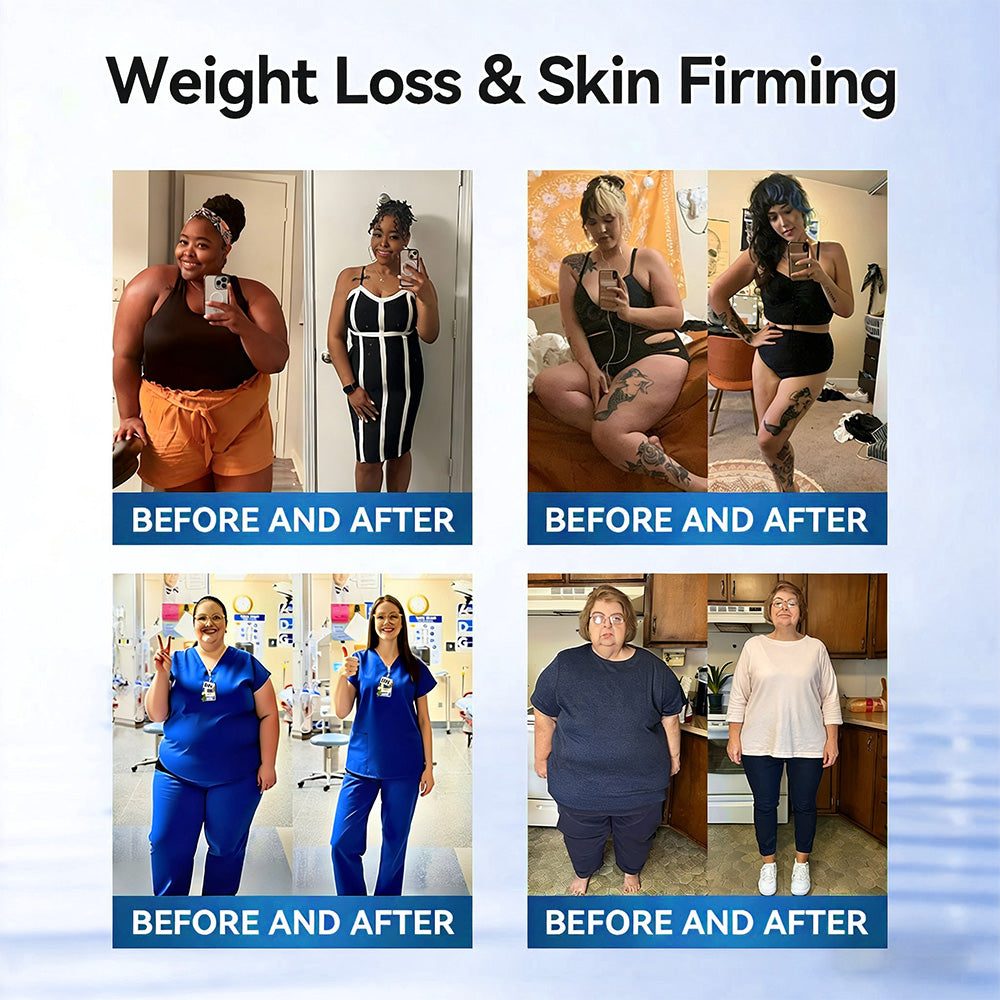 𝑶𝒇𝒇𝒊𝒄𝒊𝒂𝒍 𝑺𝒕𝒐𝒓𝒆  |  💙𝐇𝐞𝐚𝐥𝐫𝐢𝐳𝐞® 𝙈𝒐𝒓𝒊𝒏𝒈𝗮 · 𝗕𝗲𝗿𝗯𝐞𝐫𝐢𝐧𝙚 × 𝙉𝑨𝑫+ 𝟏𝟎-𝙞𝙣-𝟏 𝘼𝒅𝒗𝒂𝒏𝒄𝒆𝐝 𝐍𝐚𝐧𝙤 𝙈𝙞𝙘𝙧𝙤𝙣𝒆𝒆𝒅𝒍𝐞 𝐏𝐚𝐭𝙘𝙝(𝐉𝐮𝐬𝐭 𝐨𝐧𝐜𝐞 𝐚 𝐝𝐚𝐲, 𝐯𝐢𝐬𝐢𝐛𝐥𝐞 𝐜𝐡𝐚𝐧𝐠𝐞𝐬 𝐢𝐧 𝟕 𝐝𝐚𝐲𝐬） ✅ 𝐅𝐨𝐫 𝐨𝐛𝐞𝐬𝐢𝐭𝐲, 🅛🅞🅞🅢🅔 🅢🅚🅘🅝,𝐝𝐢𝐚𝐛𝐞𝐭𝐞𝐬, 𝐬𝐥𝐞𝐞𝐩 𝐚𝐩𝐧𝐞𝐚, 𝐣𝐨𝐢𝐧𝐭 𝐢𝐬𝐬𝐮𝐞𝐬, 𝐚𝐧𝐝 𝐦𝐨𝐫𝐞