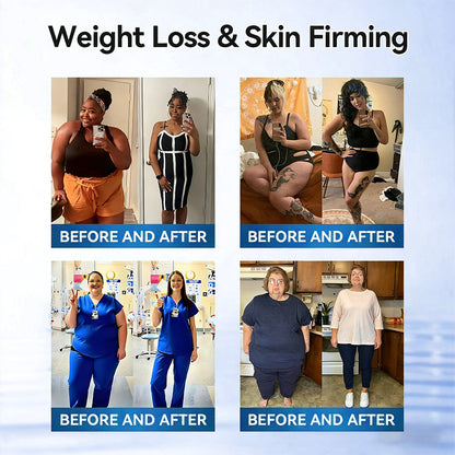 𝑶𝒇𝒇𝒊𝒄𝒊𝒂𝒍 𝑺𝒕𝒐𝒓𝒆  |  💙𝐇𝐞𝐚𝐥𝐫𝐢𝐳𝐞® 𝙈𝒐𝒓𝒊𝒏𝒈𝗮 · 𝗕𝗲𝗿𝗯𝐞𝐫𝐢𝐧𝙚 × 𝙉𝑨𝑫+ 𝟏𝟎-𝙞𝙣-𝟏 𝘼𝒅𝒗𝒂𝒏𝒄𝒆𝐝 𝐍𝐚𝐧𝙤 𝙈𝙞𝙘𝙧𝙤𝙣𝒆𝒆𝒅𝒍𝐞 𝐏𝐚𝐭𝙘𝙝(𝐉𝐮𝐬𝐭 𝐨𝐧𝐜𝐞 𝐚 𝐝𝐚𝐲, 𝐯𝐢𝐬𝐢𝐛𝐥𝐞 𝐜𝐡𝐚𝐧𝐠𝐞𝐬 𝐢𝐧 𝟕 𝐝𝐚𝐲𝐬） ✅ 𝐅𝐨𝐫 𝐨𝐛𝐞𝐬𝐢𝐭𝐲, 🅛🅞🅞🅢🅔 🅢🅚🅘🅝,𝐝𝐢𝐚𝐛𝐞𝐭𝐞𝐬, 𝐬𝐥𝐞𝐞𝐩 𝐚𝐩𝐧𝐞𝐚, 𝐣𝐨𝐢𝐧𝐭 𝐢𝐬𝐬𝐮𝐞𝐬, 𝐚𝐧𝐝 𝐦𝐨𝐫𝐞