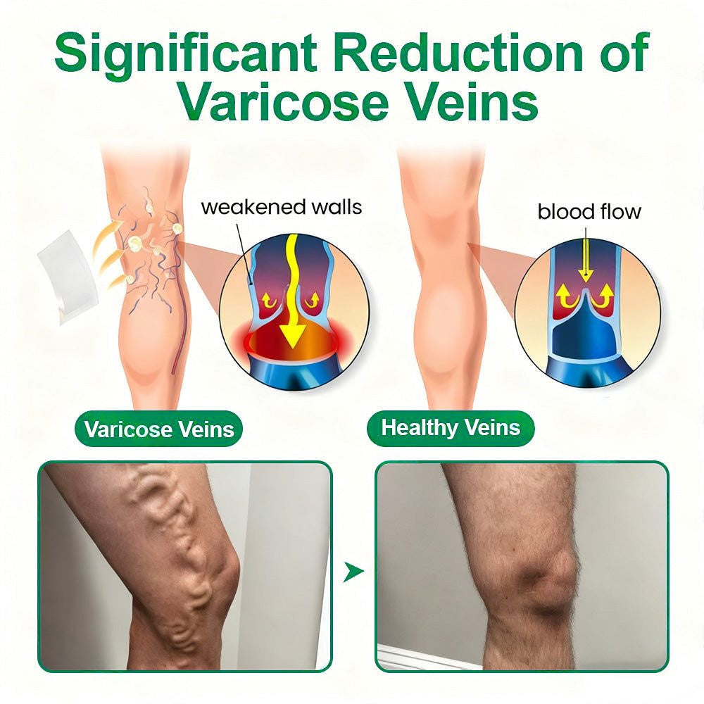 🇦🇺🥇✅ 𝐇𝐞𝐚𝐥𝐫𝐢𝐳𝐞® VеіnТаrgеt Місrоnееdlе Раtсh⚡Instant Relief, Long-Term Results
