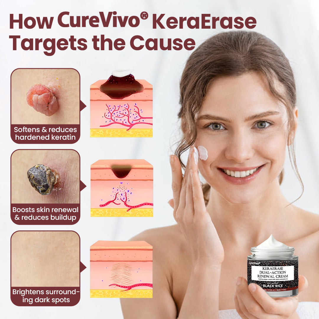 𝑶𝒇𝒇𝒊𝒄𝒊𝒂𝒍 𝒔𝒕𝒐𝒓𝒆丨🩺 𝑪𝒖𝒓𝒆𝑽𝒊𝒗𝒐®  Dual-Action Renewal Cream KeraErase.