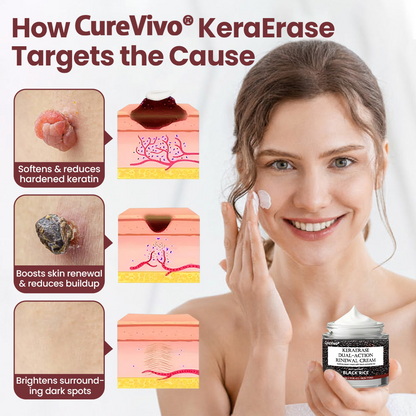 𝑶𝒇𝒇𝒊𝒄𝒊𝒂𝒍 𝒔𝒕𝒐𝒓𝒆丨🩺 𝑪𝒖𝒓𝒆𝑽𝒊𝒗𝒐®  Dual-Action Renewal Cream KeraErase.