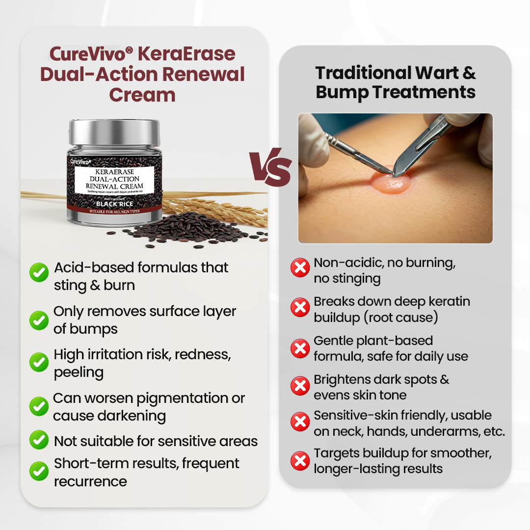 𝑶𝒇𝒇𝒊𝒄𝒊𝒂𝒍 𝒔𝒕𝒐𝒓𝒆丨🩺 𝑪𝒖𝒓𝒆𝑽𝒊𝒗𝒐®  Dual-Action Renewal Cream KeraErase.
